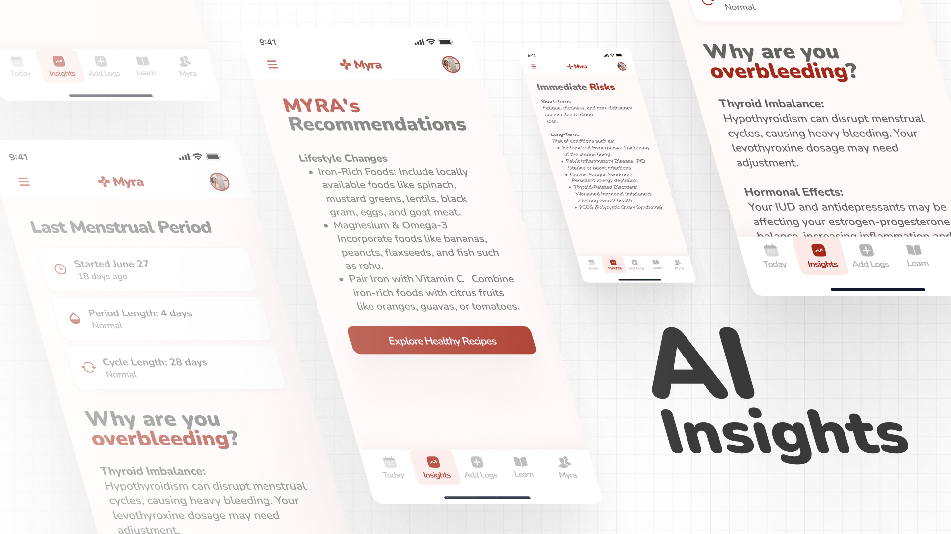 Cover for AI Insights